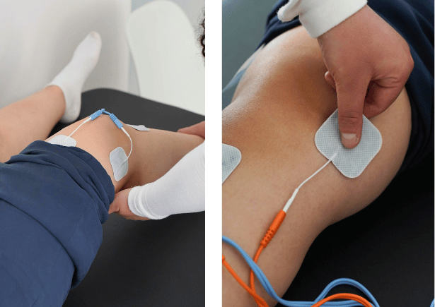 how neuromuscular electrostimulation can help long covid patients recover thanks to physiotherapy