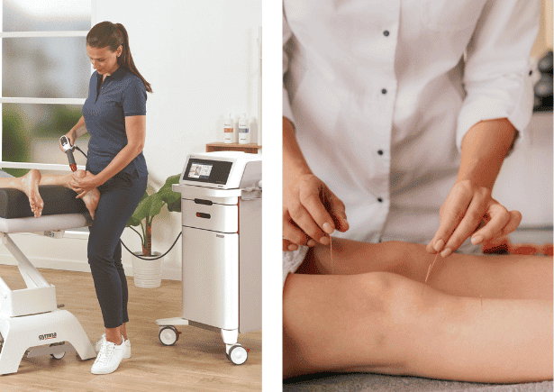 Shockwave therapy and dry needling to treat tendinitis 
