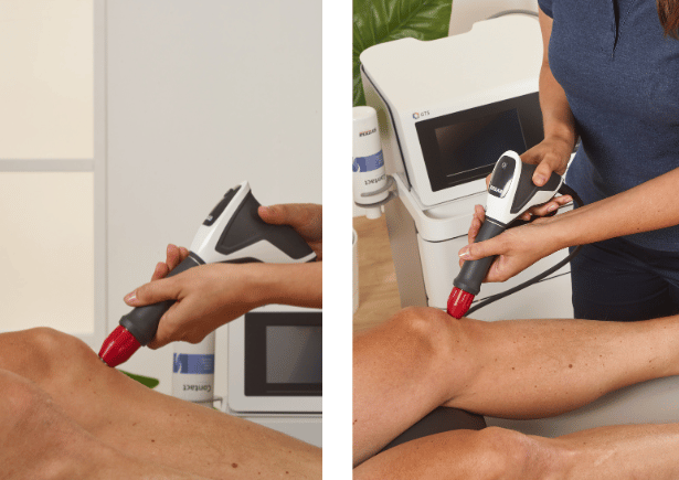 how shockwave can help treat knee osteoarthritis