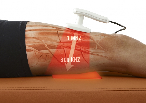Diathermy explanation